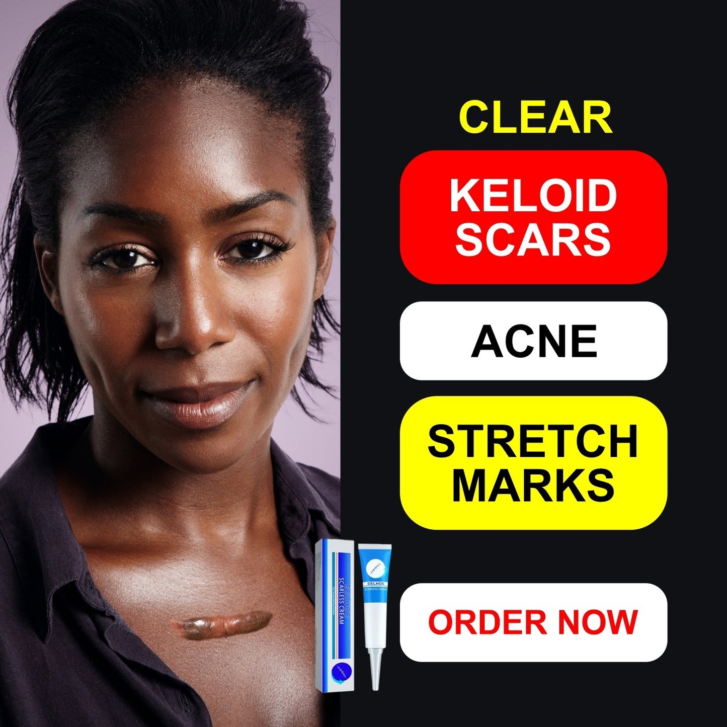 BEST SCAR REMOVER CREAM™