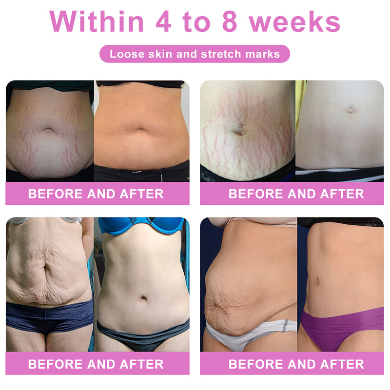 👑Anyidea™ Negative Ion Fat Burning, Tummy Tucking, Detoxifying Shaping Pants