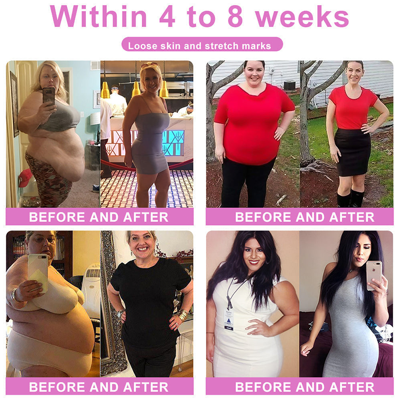 👑Anyidea™ Negative Ion Fat Burning, Tummy Tucking, Detoxifying Shaping Pants