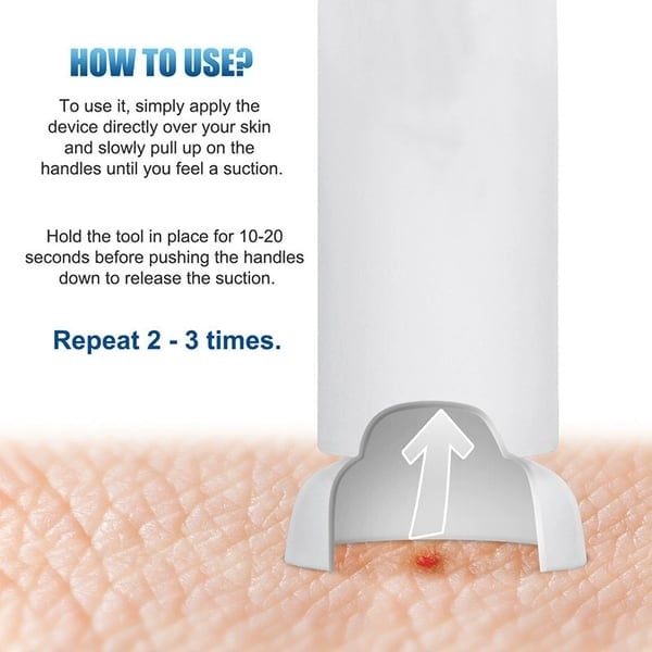🦟 Experience Instant Relief ✨ Ultimate Bite & Sting Relief Tool - For Itch-Free, Comfortable Days!
