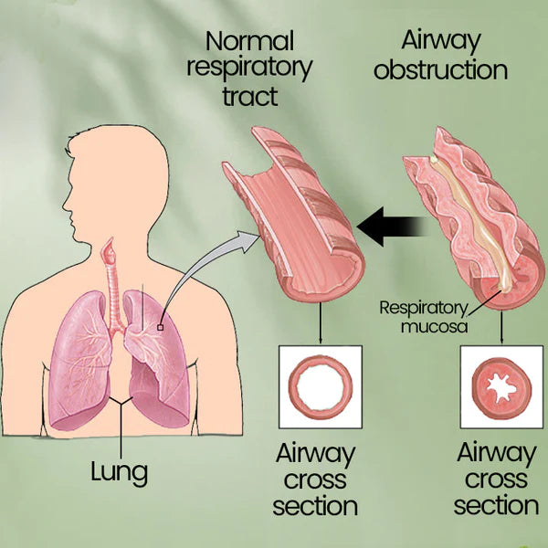 Ceoerty™ Herbal Lung Cleanse and Repair Mist