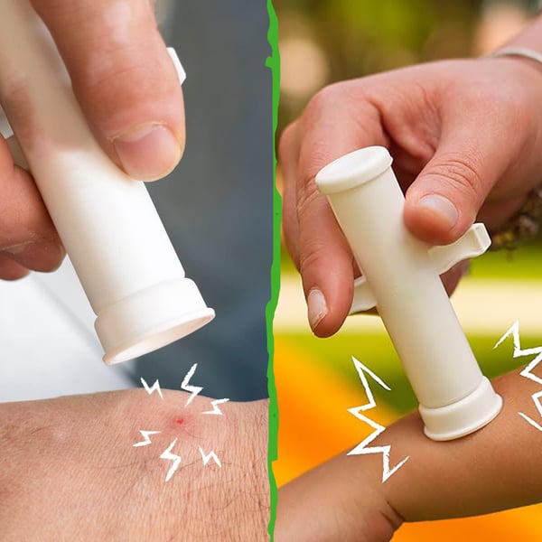 🦟 Experience Instant Relief ✨ Ultimate Bite & Sting Relief Tool - For Itch-Free, Comfortable Days!