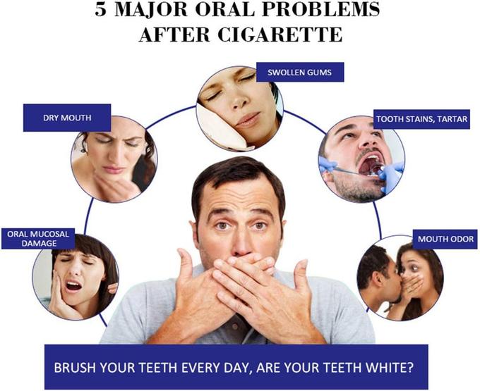 Intensive Stain Removal Whitening Toothpaste【🚚CASH ON DELIVERY + LOCAL STOCK (EXPRESS 3 DAY DELIVERY)】