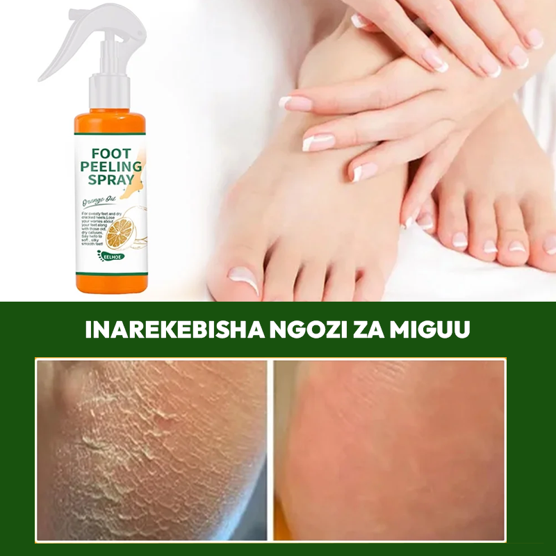 🔥2025 HOT SALE -Foot Peeling Spray🔥HOT SALE 45%🔥