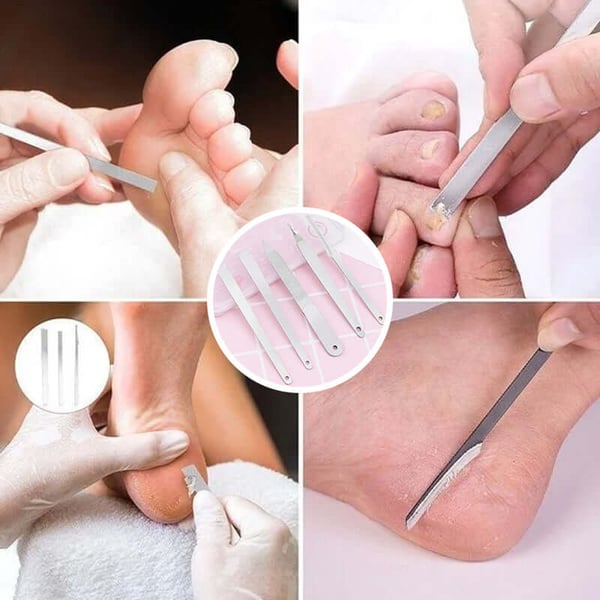 Professional Pedicure Tools (5 PCS)🔥LAST DAY Promotion 45% OFF🔥