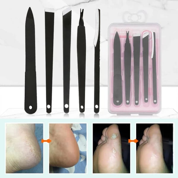 Professional Pedicure Tools (5 PCS)🔥LAST DAY Promotion 45% OFF🔥