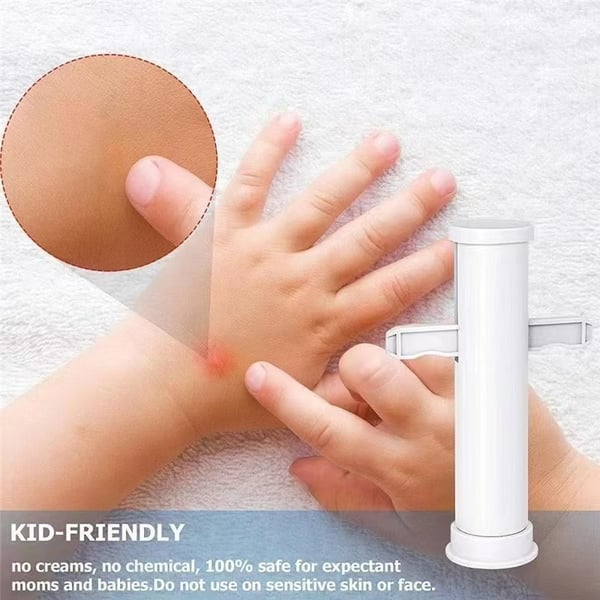🦟 Experience Instant Relief ✨ Ultimate Bite & Sting Relief Tool - For Itch-Free, Comfortable Days!