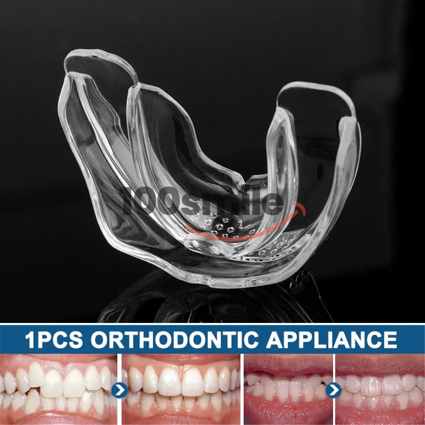 Ultra Aligner Smile Max Braces
