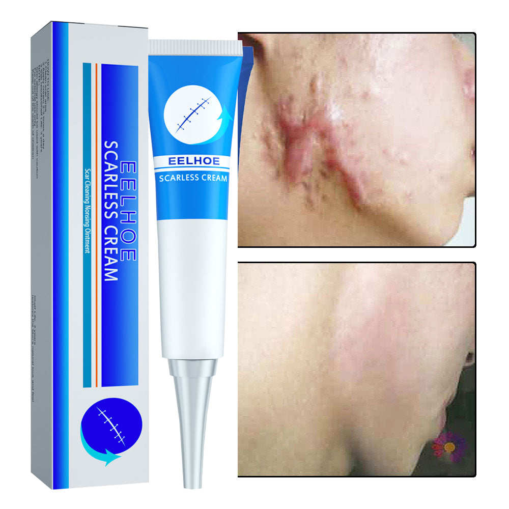 BEST SCAR REMOVER CREAM™