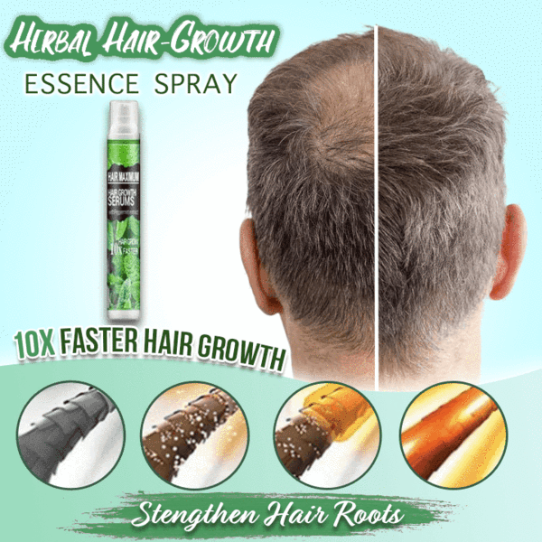 Herbal Hair-Growth Essence Spray【INCOD + Local Stock (Express 3 Day Delivery)】