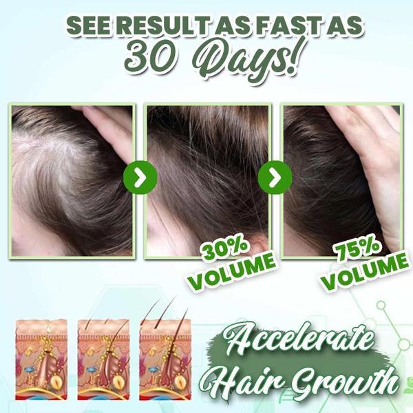 Herbal Hair-Growth Essence Spray【INCOD + Local Stock (Express 3 Day Delivery)】