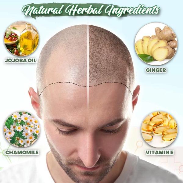 Herbal Hair-Growth Essence Spray【INCOD + Local Stock (Express 3 Day Delivery)】