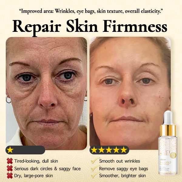 Unibeaute™ 24K Gold Wrinkle-refining Snail Serum【HOT SALE-49%OFF🔥🔥🔥】