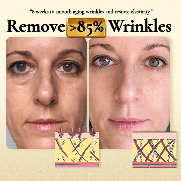 Unibeaute™ 24K Gold Wrinkle-refining Snail Serum【HOT SALE-49%OFF🔥🔥🔥】