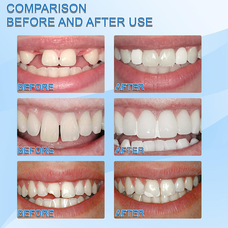 Latest👨⚕Tooth Repair Granules😁 (💥48% OFF) - 🔥HOT SALE🔥🎉 【🇮🇳COD + Local Stock !!!】【Invalid refund】