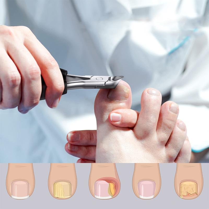304 stainless steel nail clipper set【HOT SALE-49%OFF🔥🔥🔥🔥🔥】