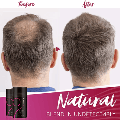 Hair Fluffy up Fiber Powder【3 Day Delivery&Cash on delivery-HOT SALE-48%OFF🔥】