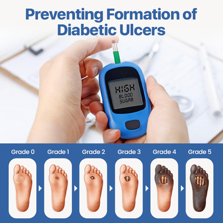 Biancat® VitaGluco Diabetes Treatment Cream【🎌From japan🎌】