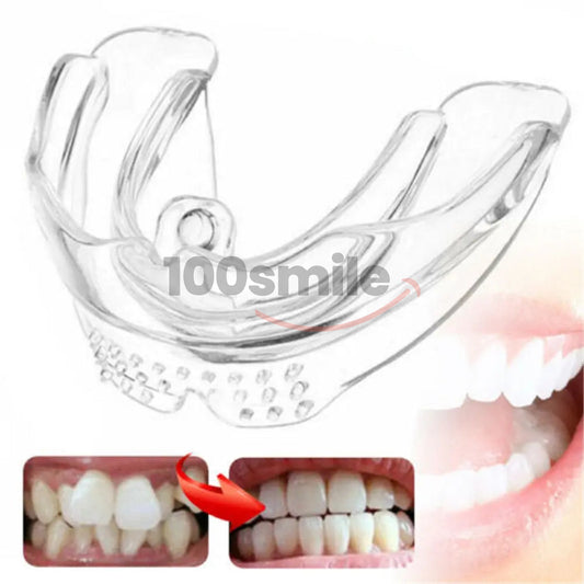 Ultra Aligner Smile Max Braces